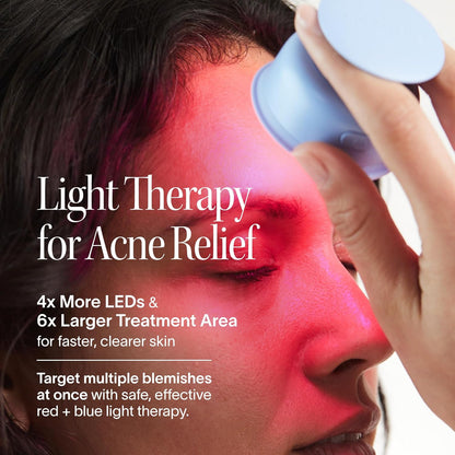 Luminous "Bye Acne" LED WAND – Red & Blue Light Therapy for Blemish-Free Skin 🌟💧