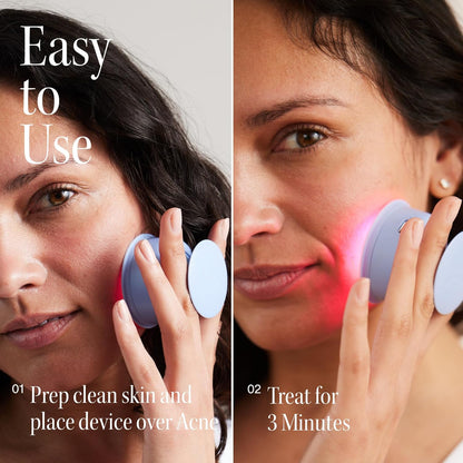 Luminous "Bye Acne" LED WAND – Red & Blue Light Therapy for Blemish-Free Skin 🌟💧