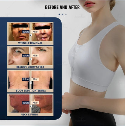 9D Professional Ultra-Sculpt: High-Intensity Focused Ultrasound (HIFU) System
