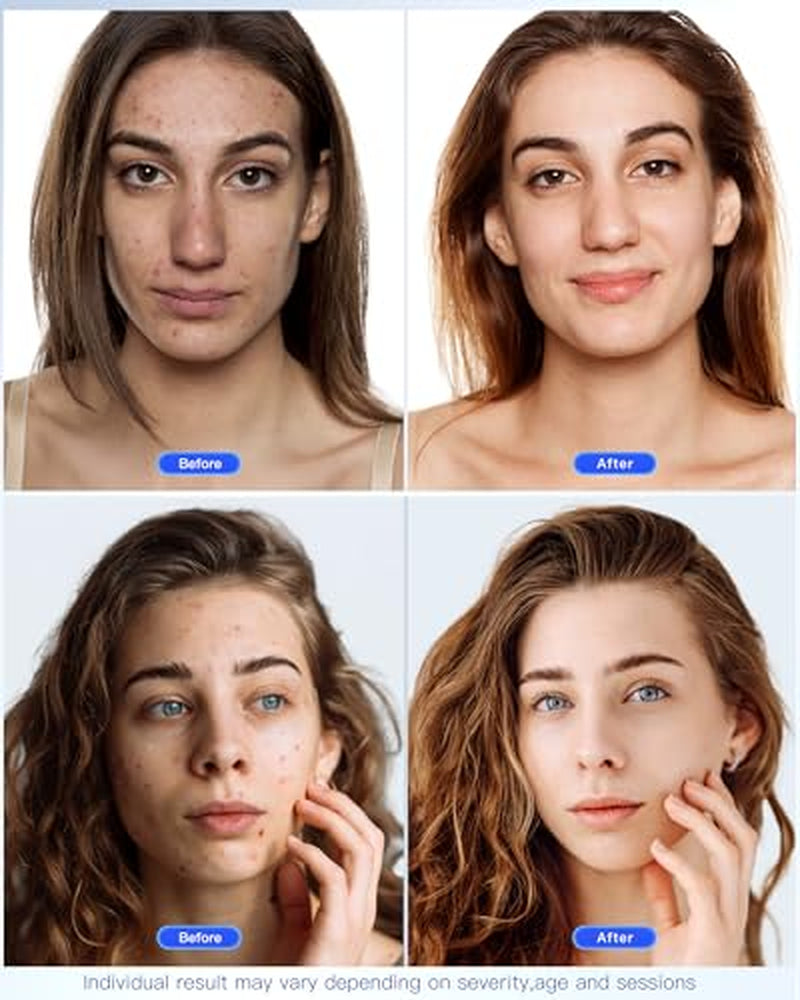NEW!! LATEST!!! 7-Mode LED Face Mask – 150 LEDs for Wrinkles, Acne & Rejuvenation 🌟