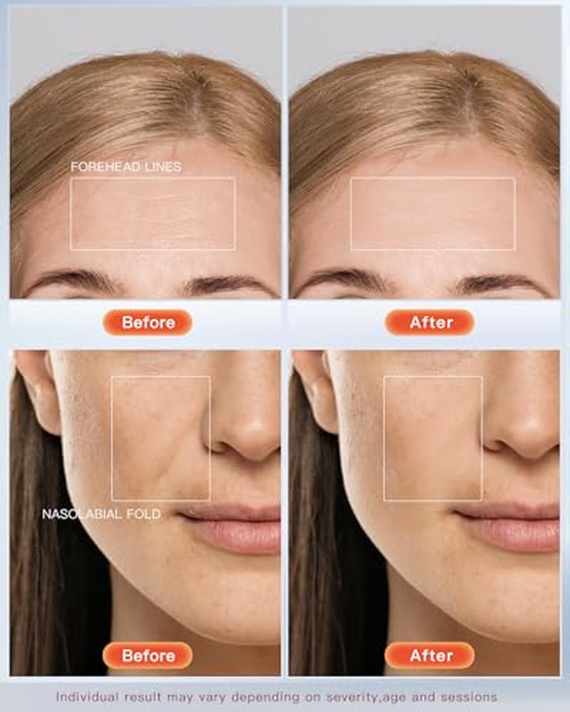 NEW!! LATEST!!! 7-Mode LED Face Mask – 150 LEDs for Wrinkles, Acne & Rejuvenation 🌟