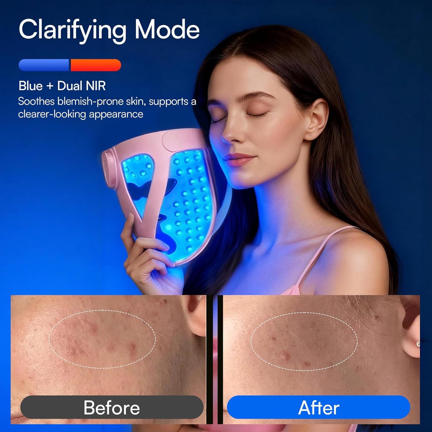 Revitalize Your Skin with the Glow 4D Wireless Red Light Therapy Mask – Dual NIR, 320 LEDs, and 4 Custom Modes for Ultimate Skincare at Home or On-the-Go!