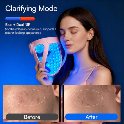 Revitalize Your Skin with the Glow 4D Wireless Red Light Therapy Mask – Dual NIR, 320 LEDs, and 4 Custom Modes for Ultimate Skincare at Home or On-the-Go!