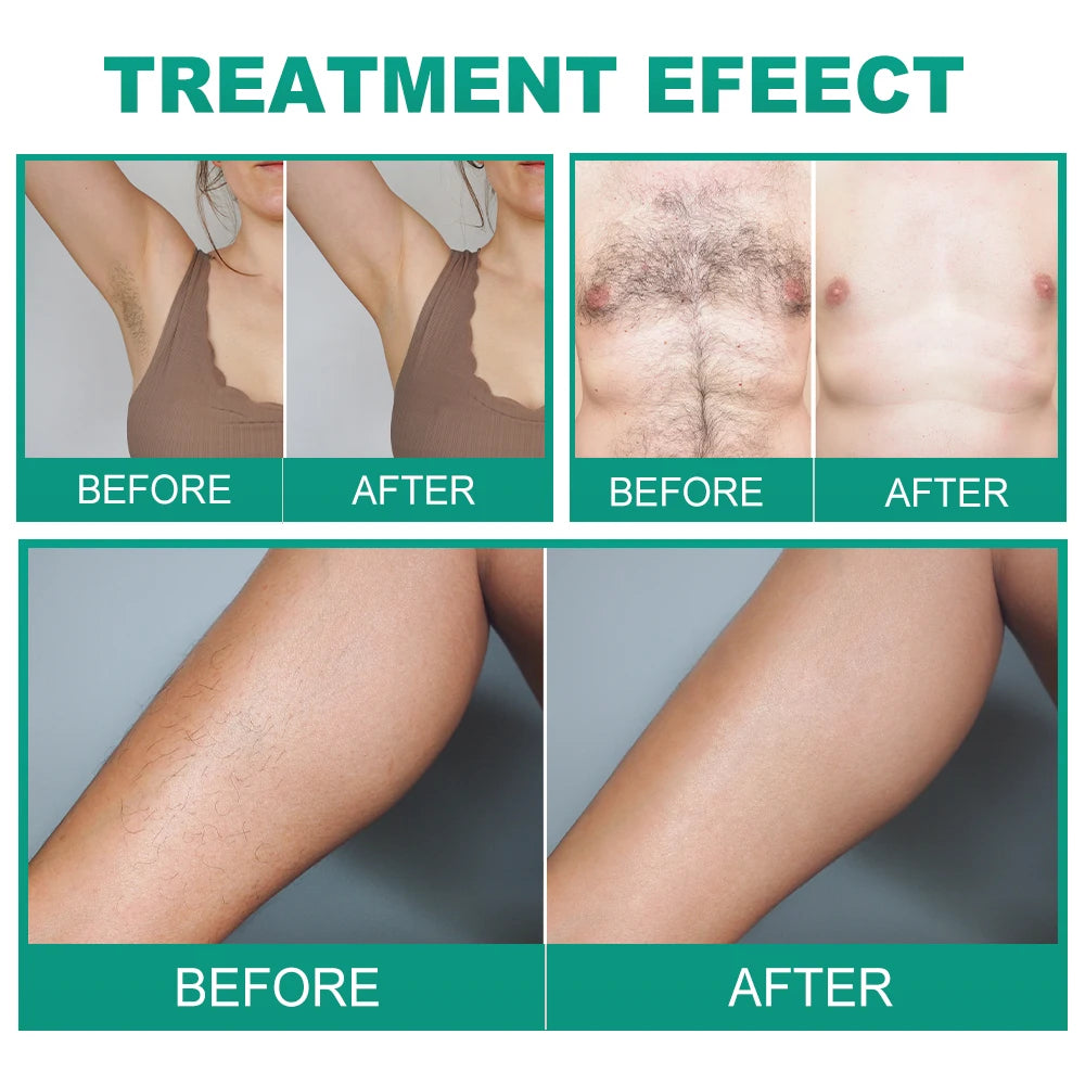 Professional Permanent Electrolysis System | Precision Galvanic Epilator for Clinical Hair Removal