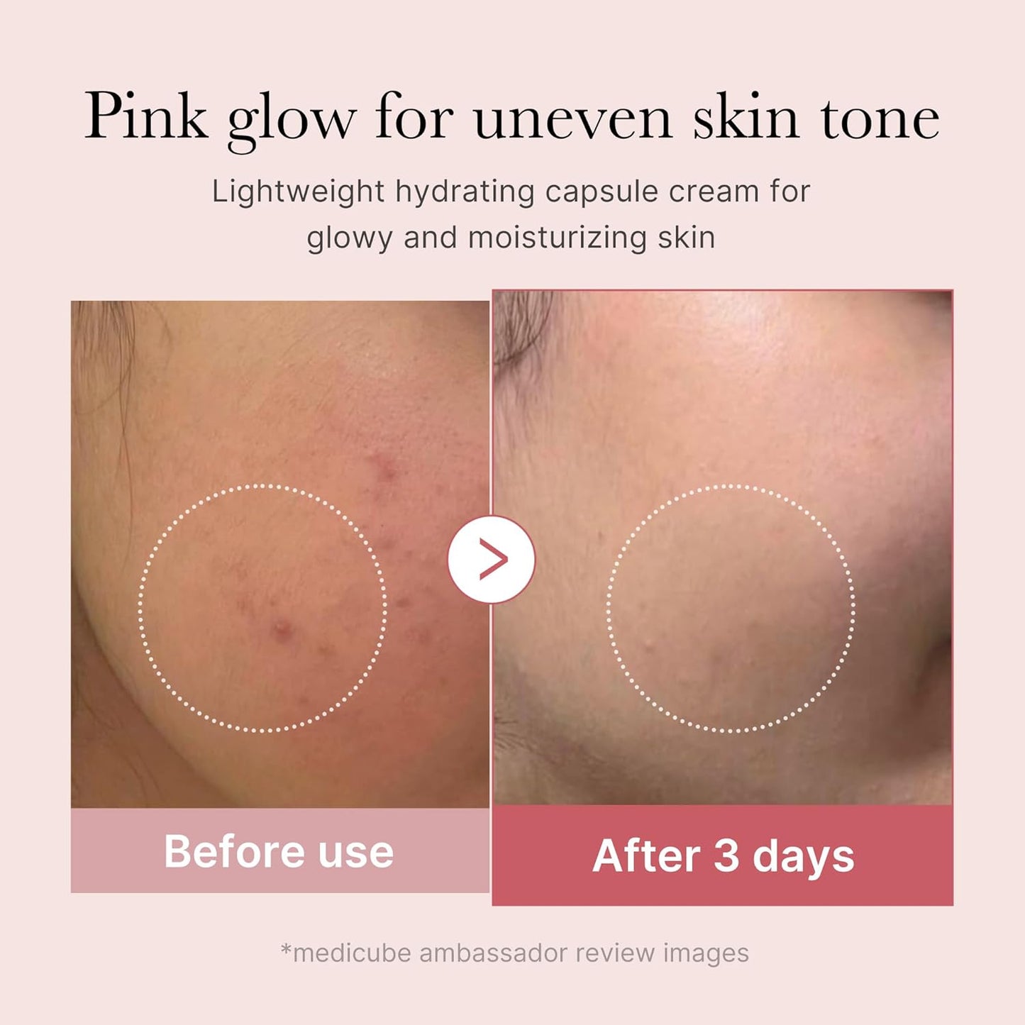 Salmon DNA PDRN Capsule Cream – Lightweight Collagen Moisturizer for Radiant Skin 🌸💧
