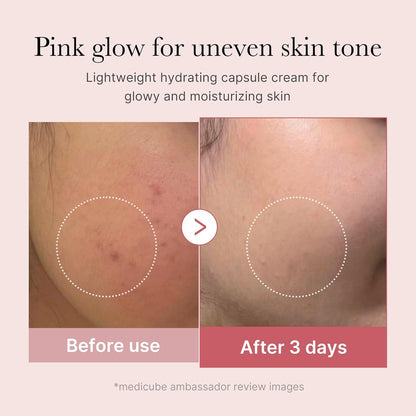 Salmon DNA PDRN Capsule Cream – Lightweight Collagen Moisturizer for Radiant Skin 🌸💧