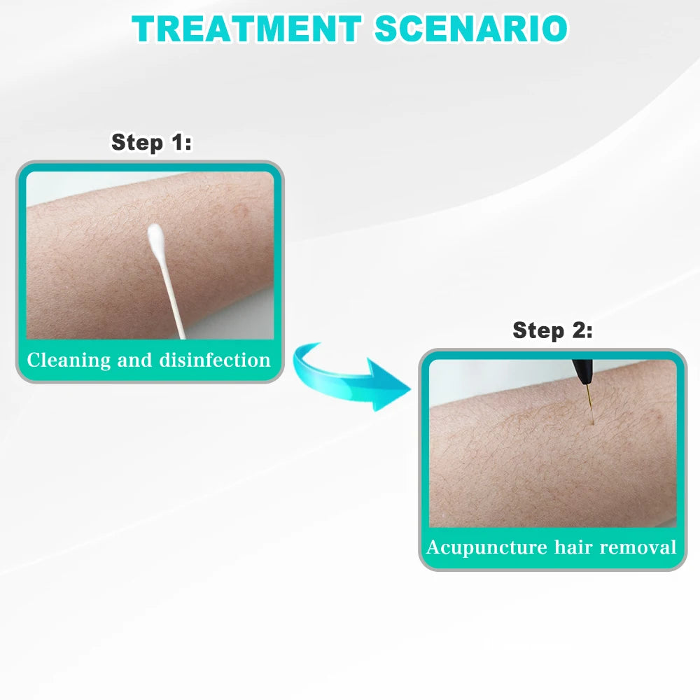 Professional Permanent Electrolysis System | Precision Galvanic Epilator for Clinical Hair Removal