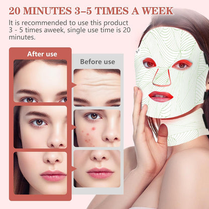 Pro 7-Color LED Face & Neck Therapy Mask – 309 High-Density Beads with 5-Level Brightness for Full-Spectrum Skin Care 🧖‍♀️