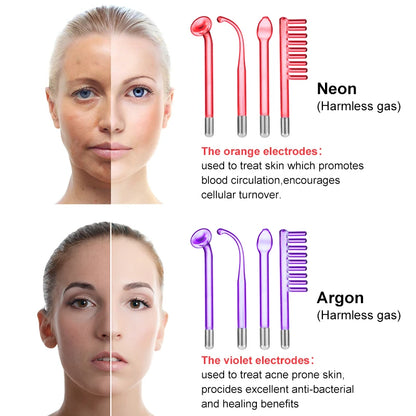 Fusion Wand Pro: Advanced Neon + Argon High-Frequency Facial ☁️