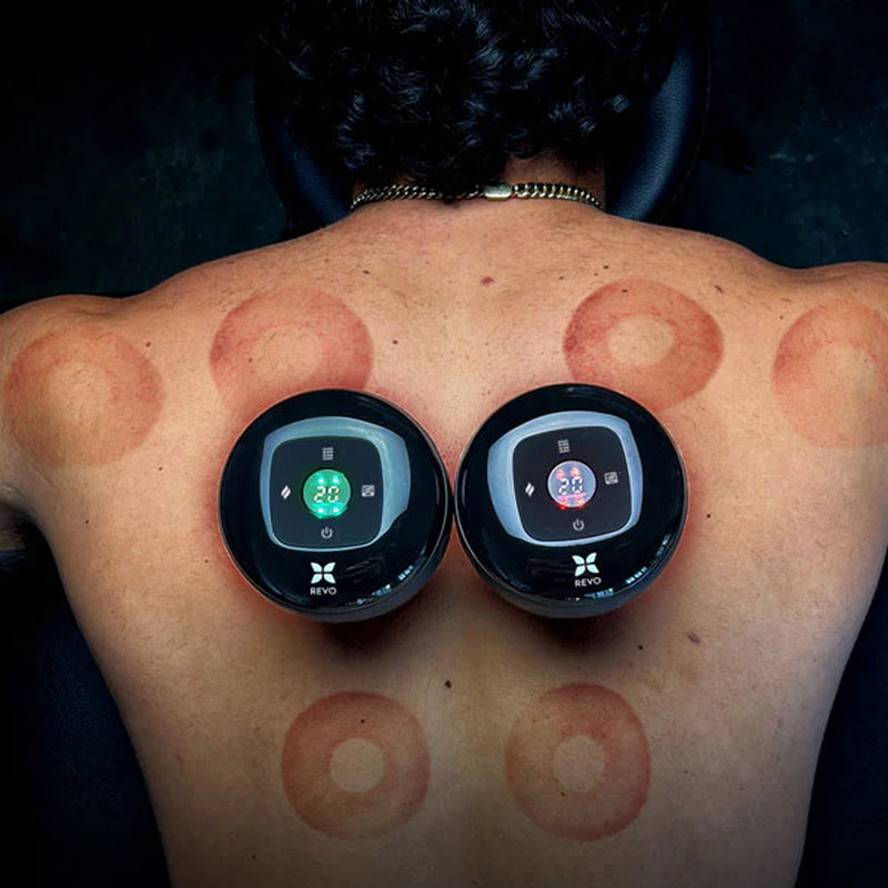 REVO™ Smart Cupping Bundle