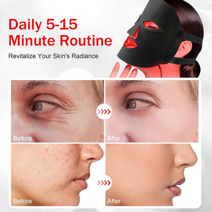Upgraded Black LED Face Mask – 7-Color Red Light Therapy for Anti-Aging, Wrinkle Removal & Professional Skin Care ✨