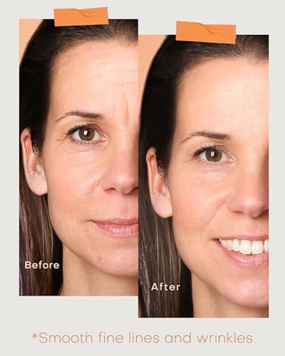NEW!! LATEST!!! PDT Cordless Red Light Therapy Mask | Silicone LED Face Mask for Wrinkles & Acne 🌟 